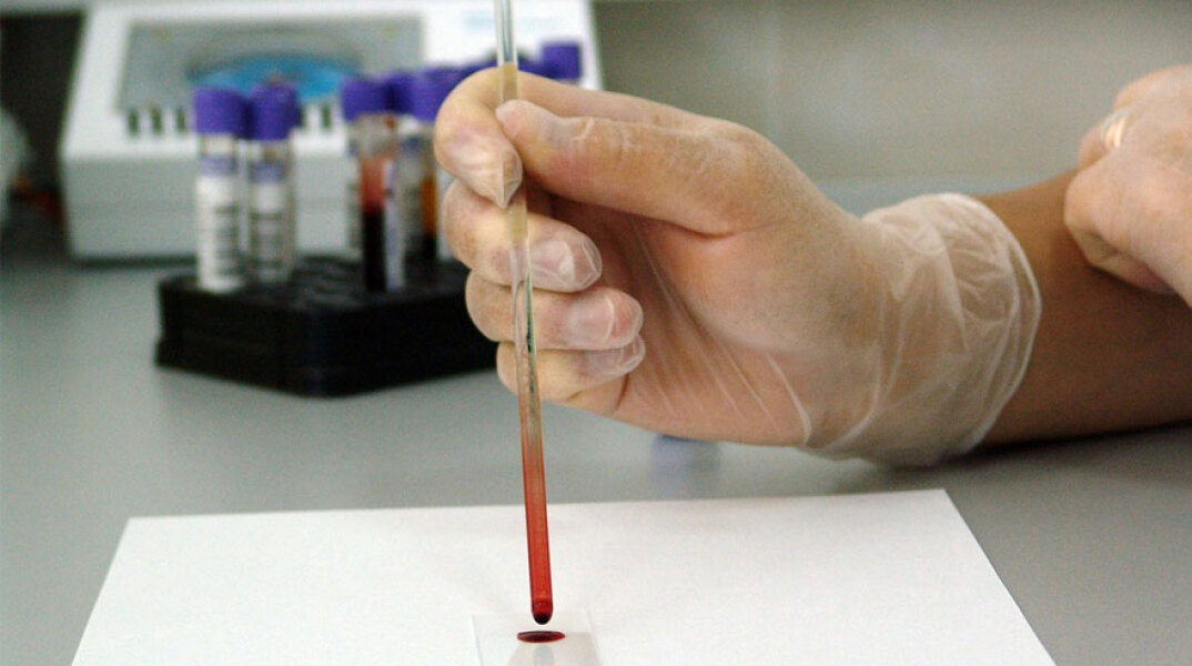 Αυξάνονται τα κρούσματα κορωνοϊού στην Κύπρο