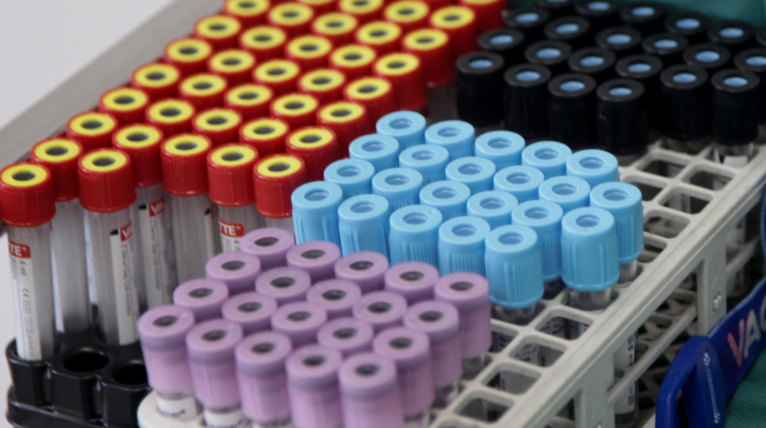 Περισσότερα τεστ για τον κορωνοϊό ζητεί το ΚΙΝΑΛ 