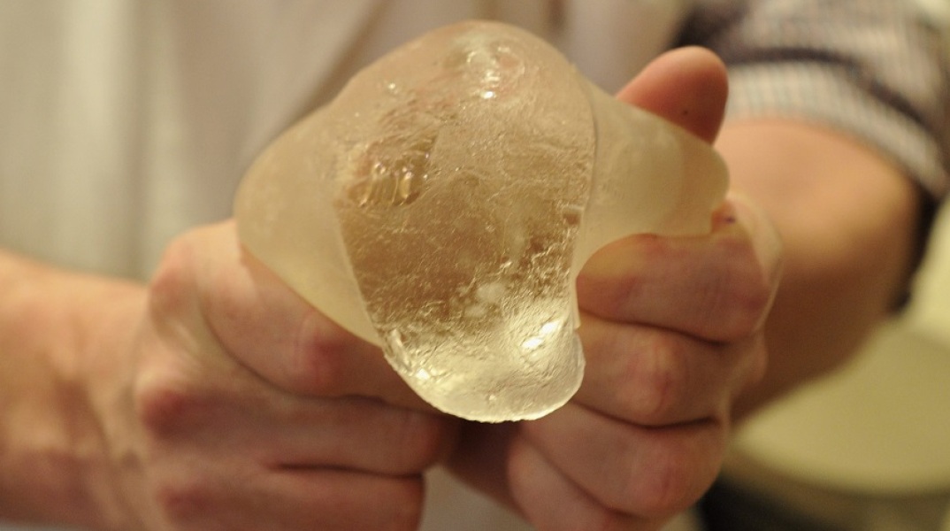 Εμφύτευμα σιλικόνης-Φωτογραφία Αρχείου