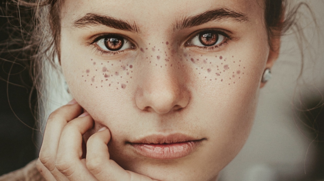 Δες 6 τρόπους που θα σε σταματήσουν από το να αγγίζεις συνεχώς το πρόσωπό σου