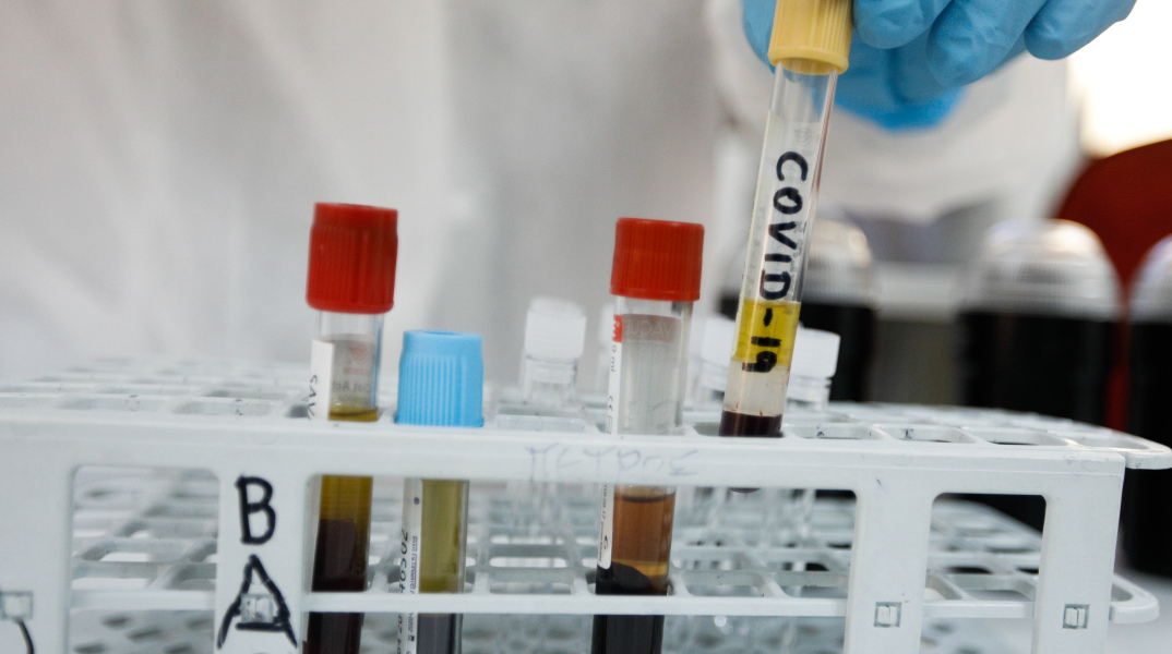 ΗΠΑ: Ο κορωνοϊός δεν φτιάχτηκε από άνθρωπο 