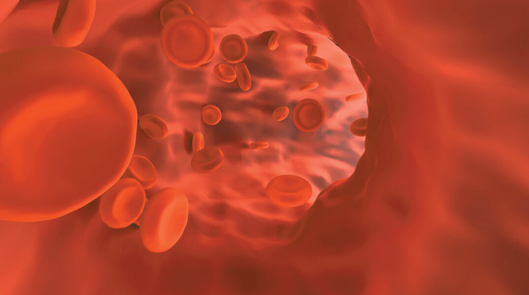 Νεότερα θεραπευτικά δεδομένα για ενήλικες ασθενείς με β-θαλασσαιμία