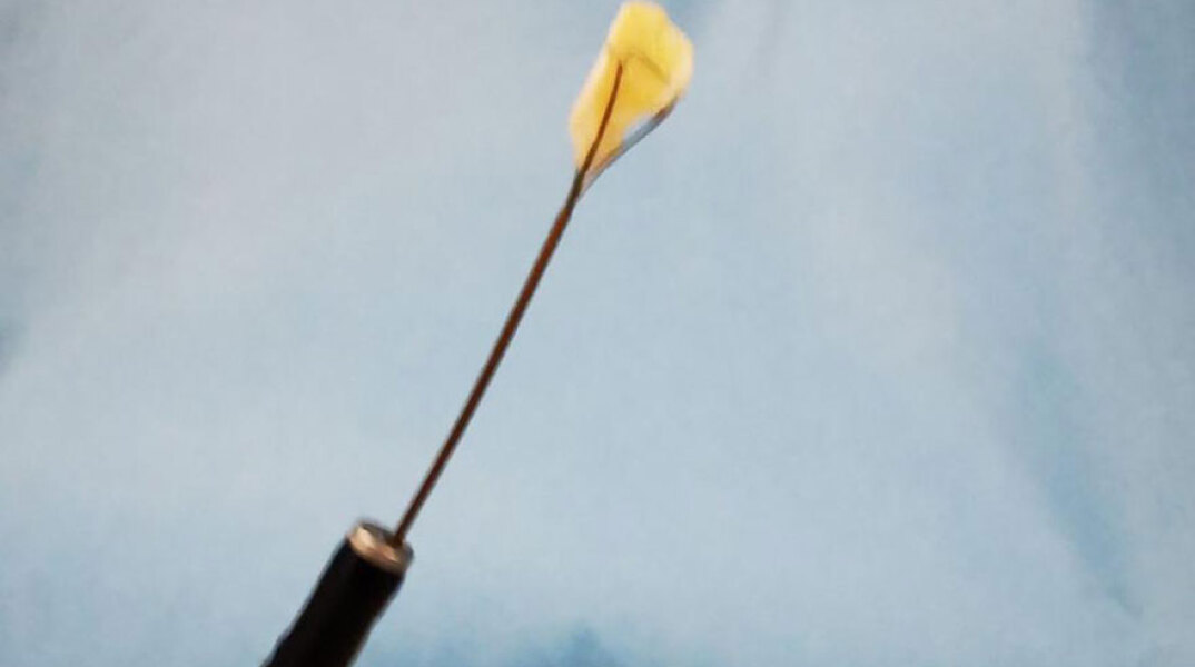 Ένα καρύδι παραλίγο να σκοτώσει τον μικρό Οδυσσέα από την Πάτρα 