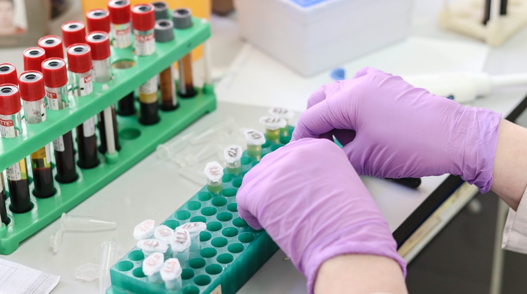 Η Κομισιόν εγκρίνει θεραπεία της εξαρτώμενης από μεταγγίσεις αναιμίας