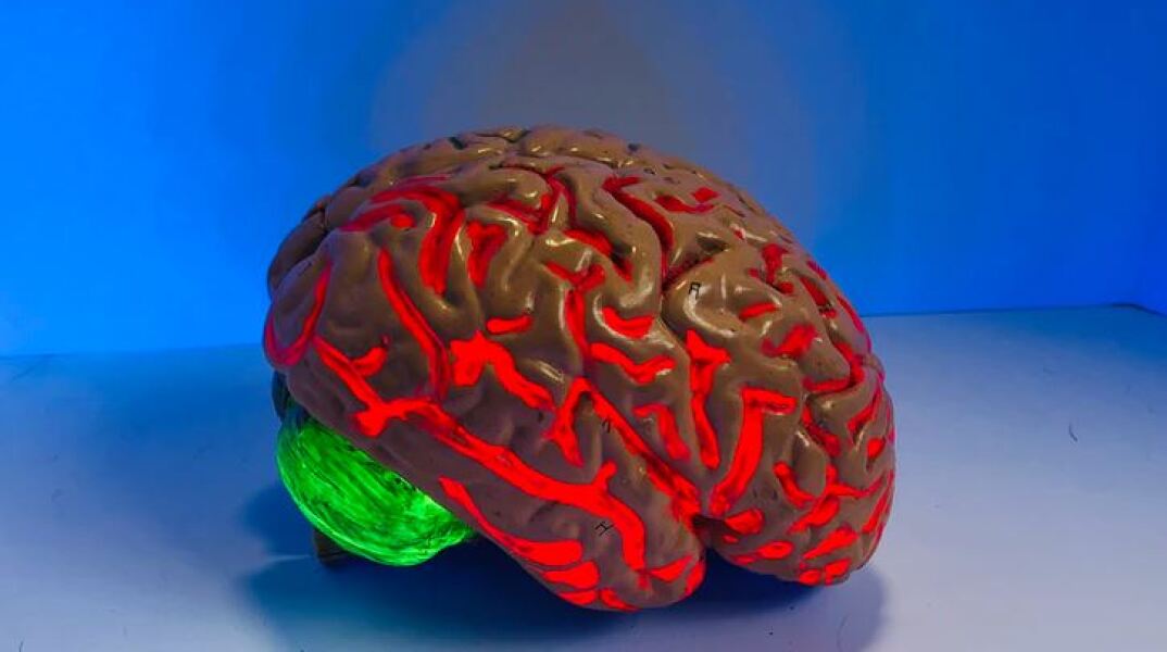 Σοβαρές εγκεφαλικές διαταραχές εμφανίζουν ασθενείς του κορωνοϊού με ήπια συμπτώματα 