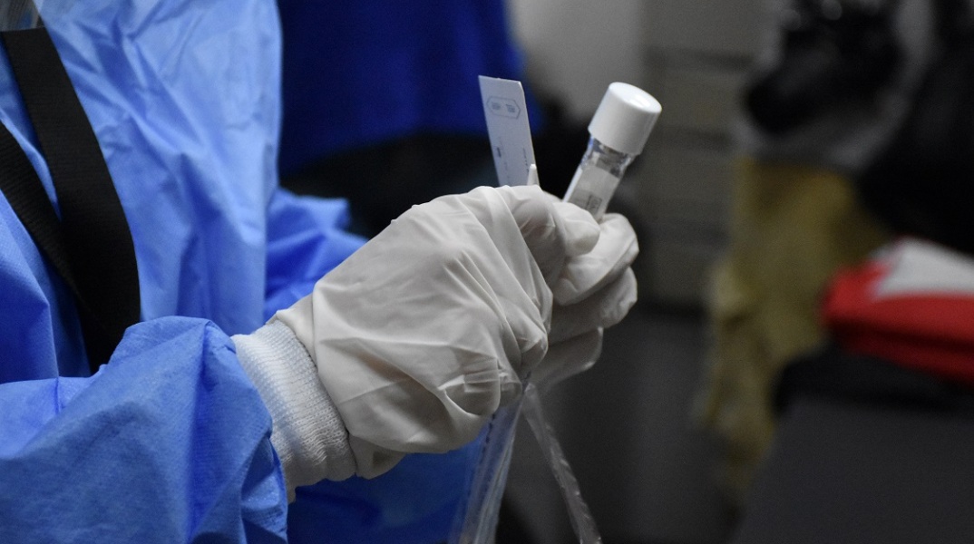 Διαγνωστικά τεστ ανίχνευσης covid-19