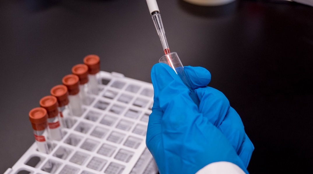 Αντισώματα 