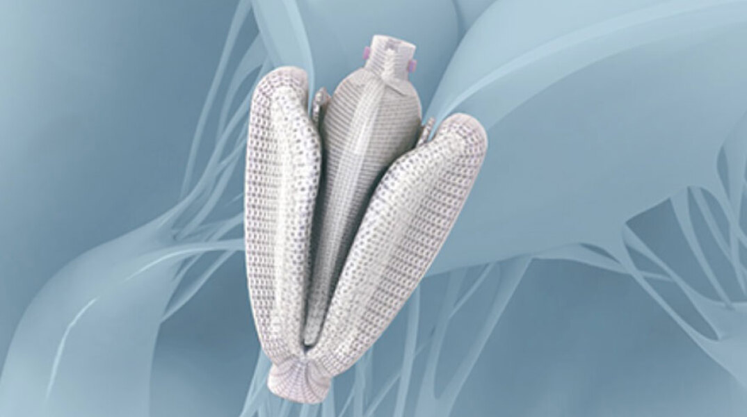 Διαδερμικές επιδιορθώσεις τριγλώχινας βαλβίδας