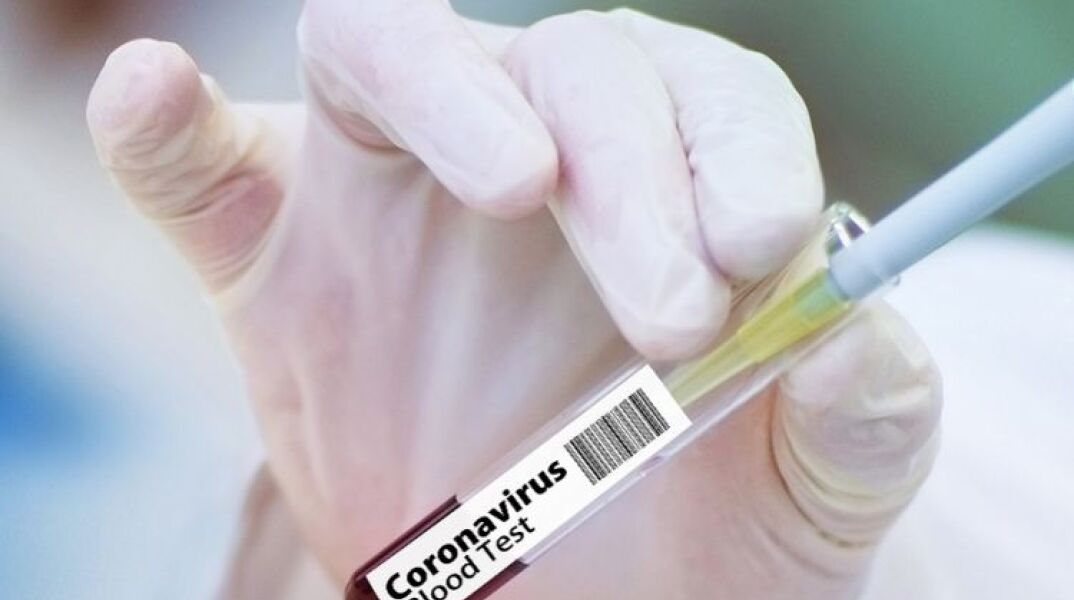 Εμβόλιο - Covid 19