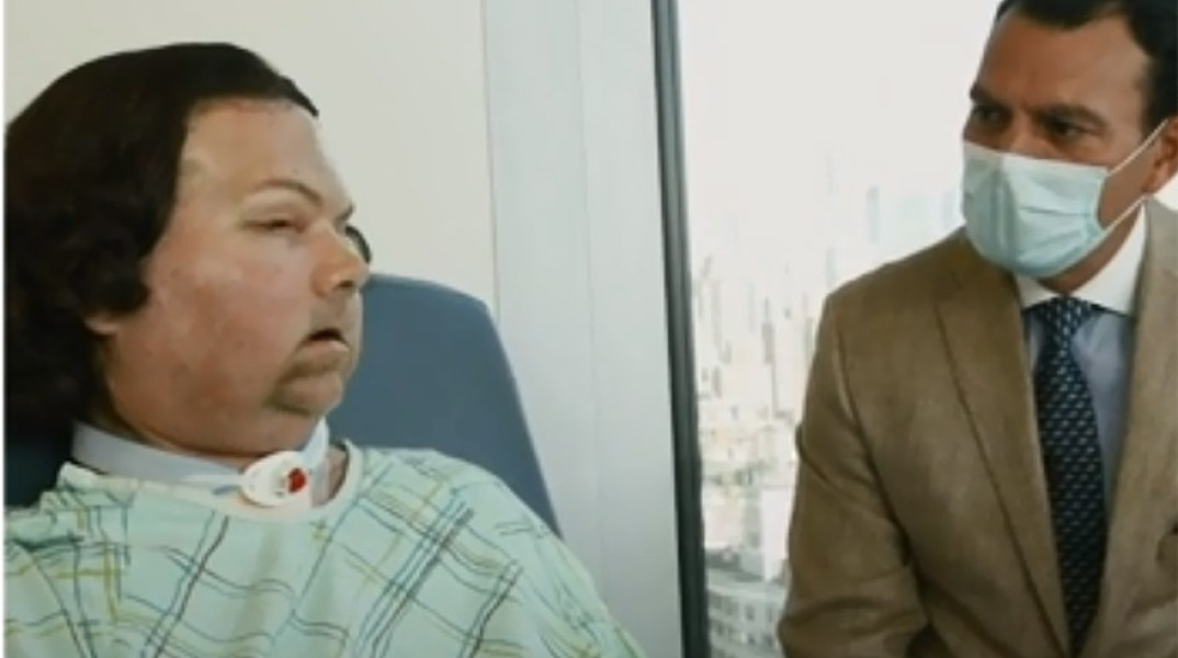 Ο 22χρονος, Τζο Ντιμίο, υποβλήθηκε με επιτυχία σε τριπλή μεταμόσχευση προσώπου και χεριών