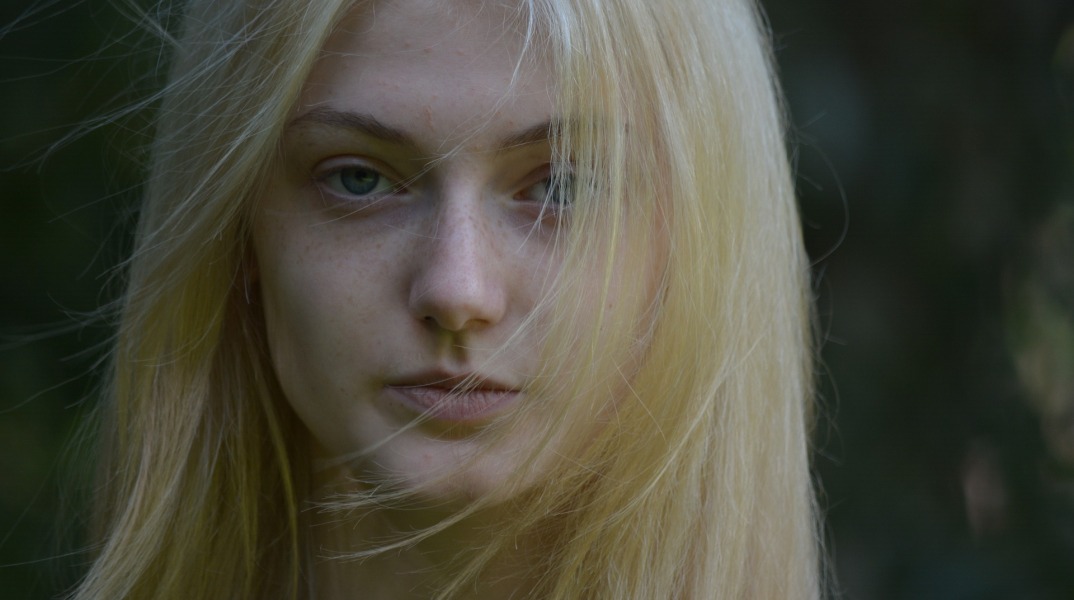 Ακμή των ενηλίκων: Πού μπορεί να οφείλεται 