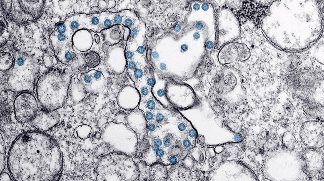 ΑΡΧΕΙΟ - Κορωνοϊός - Εικόνα από μικροσκόπιο
