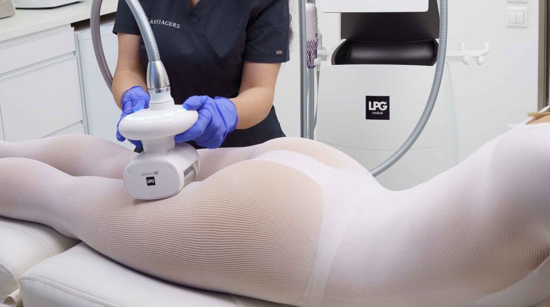 Κυτταρίτιδα: Ποια είναι τα ισχυρότερα «όπλα» εναντίον της;