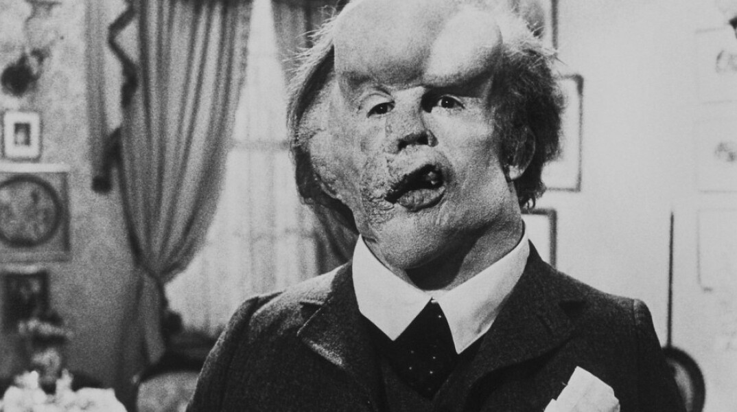 Επανέκδοση της ταινίας «Ο Άνθρωπος Ελέφαντας»