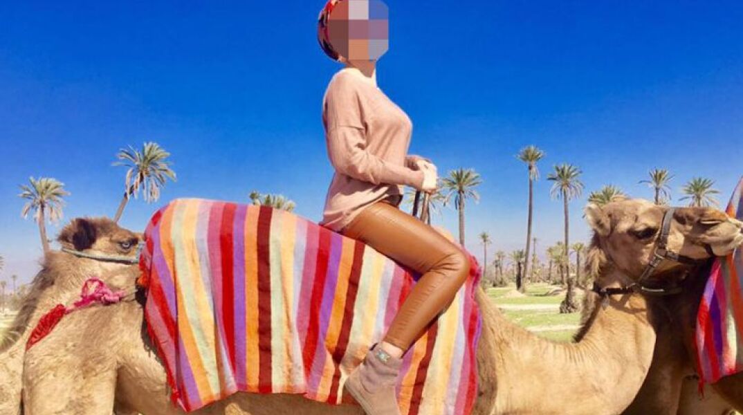 Η 34χρονη Ιωάννα που δέχθηκε επίθεση με βιτριόλι 