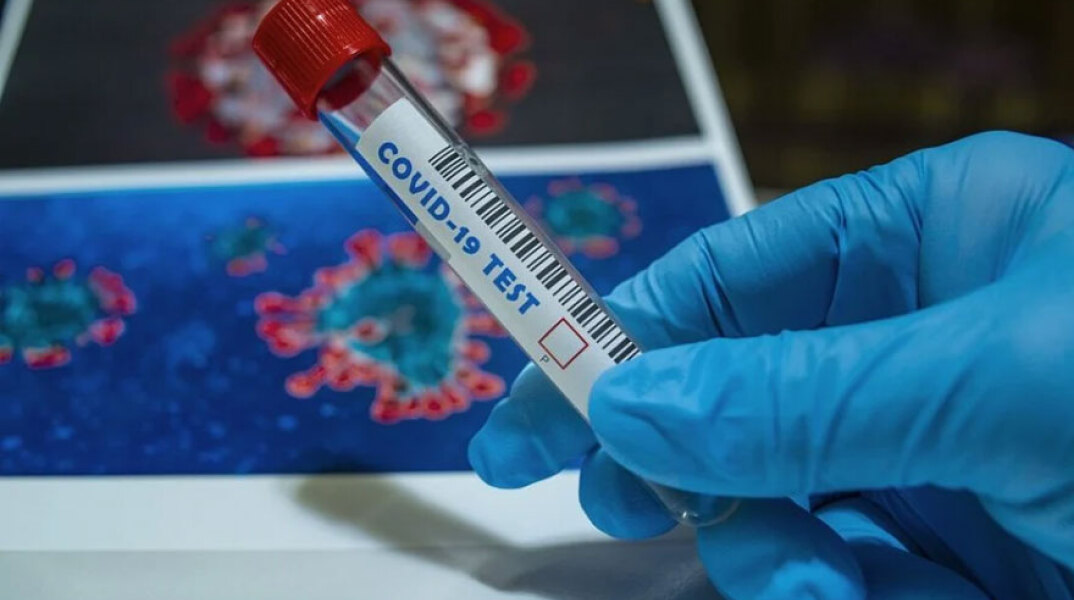 Πλαστικός σωλήνας σε εργαστήριο ανάλυσης για κορωνοϊό (ΦΩΤΟ ΑΡΧΕΙΟΥ) - Τα μονοκλωνικά αντισώματα δεν αποτελούν άμεση λύση για την πανδημία στην Ελλάδα, ξεκαθαρίζει ο Ηλίας Μόσιαλος