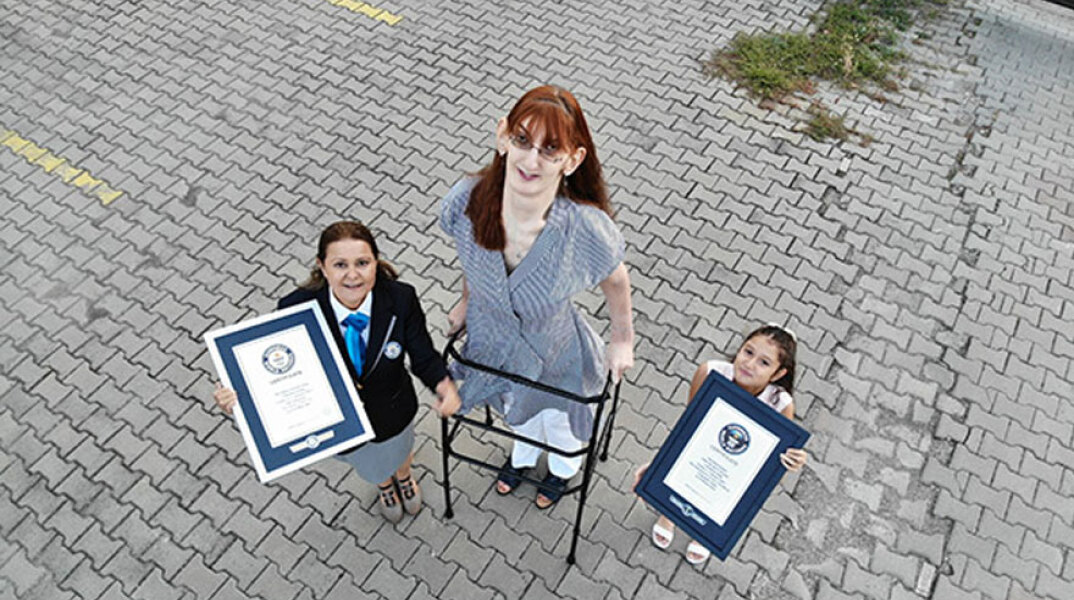 Η ψηλότερη γυναίκα στον κόσμο ονομάζεται Rumeysa Gelgi και ζει στην Τουρκία