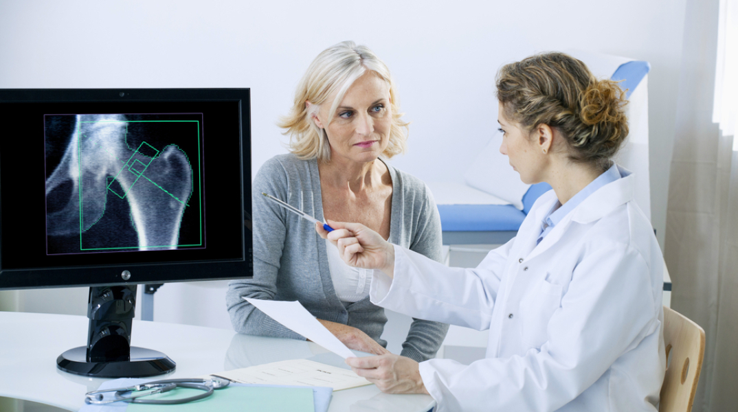 Οστεοπόρωση: Τι συμβαίνει μετά την εμμηνόπαυση; 