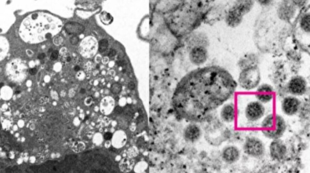 Όμικρον: Η πρώτη φωτογραφία από ηλεκτρονικό μικροσκόπιο