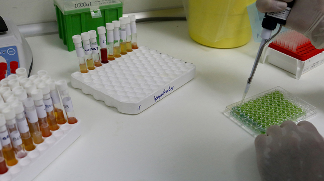 Κορωνοϊός: «Κάτω από τα 60 ευρώ το PCR test»