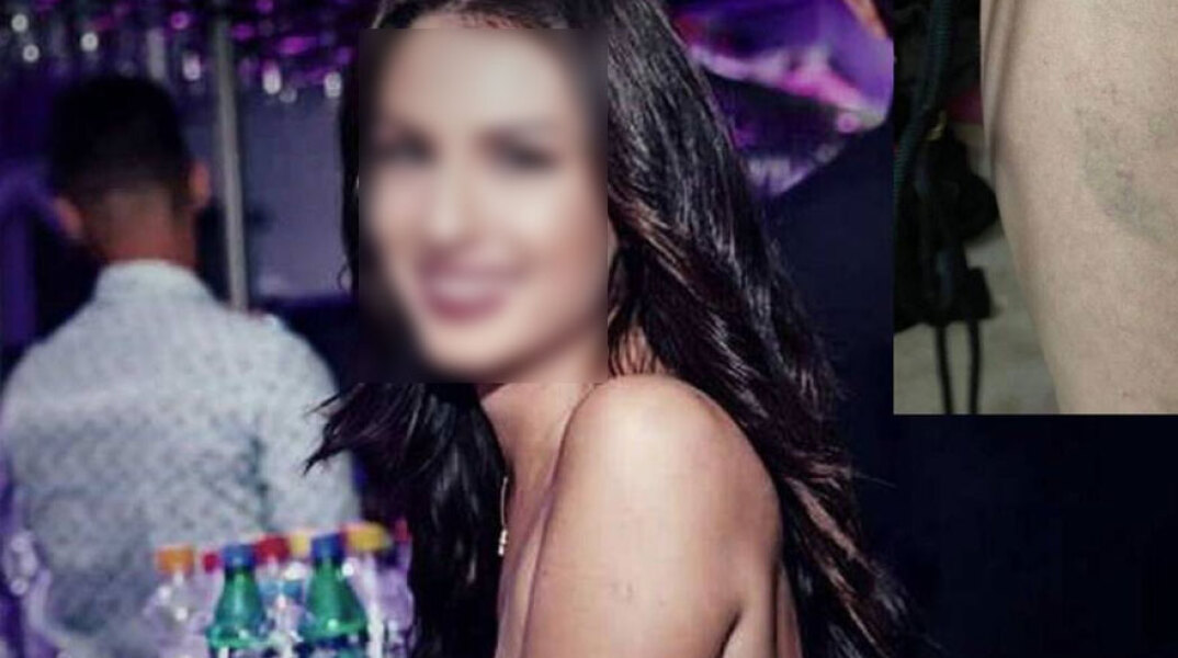 Η 24χρονη που κατήγγειλε τον βιασμό της σε ξενοδοχείο στη Θεσσαλονίκη