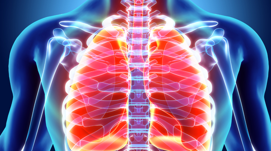 Καρκίνος του πνεύμονα: Ελάχιστα επεμβατική χειρουργική