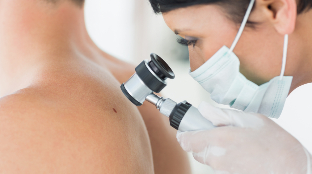 Ελπίδες για ανάπτυξη εμβολίου κατά του καρκίνου του δέρματος 