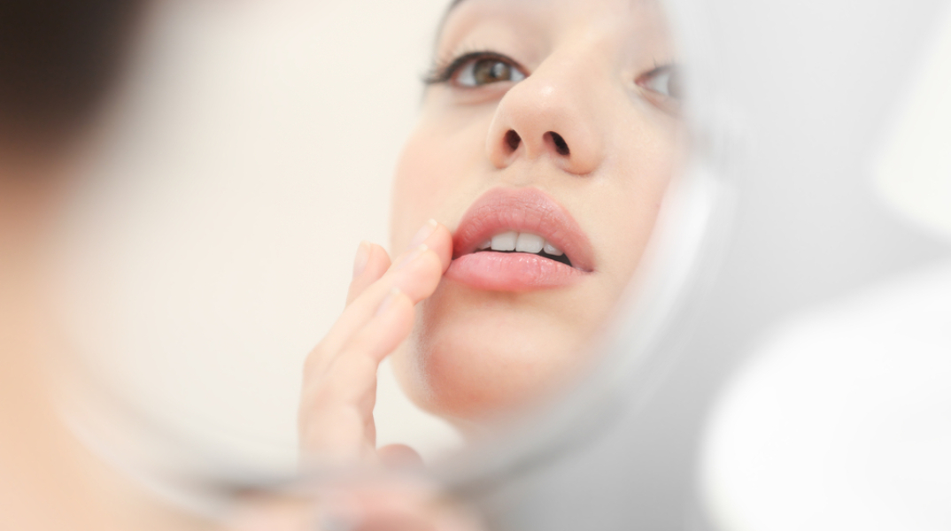 Σκασμένα χείλη: Ποιες είναι οι αιτίες;