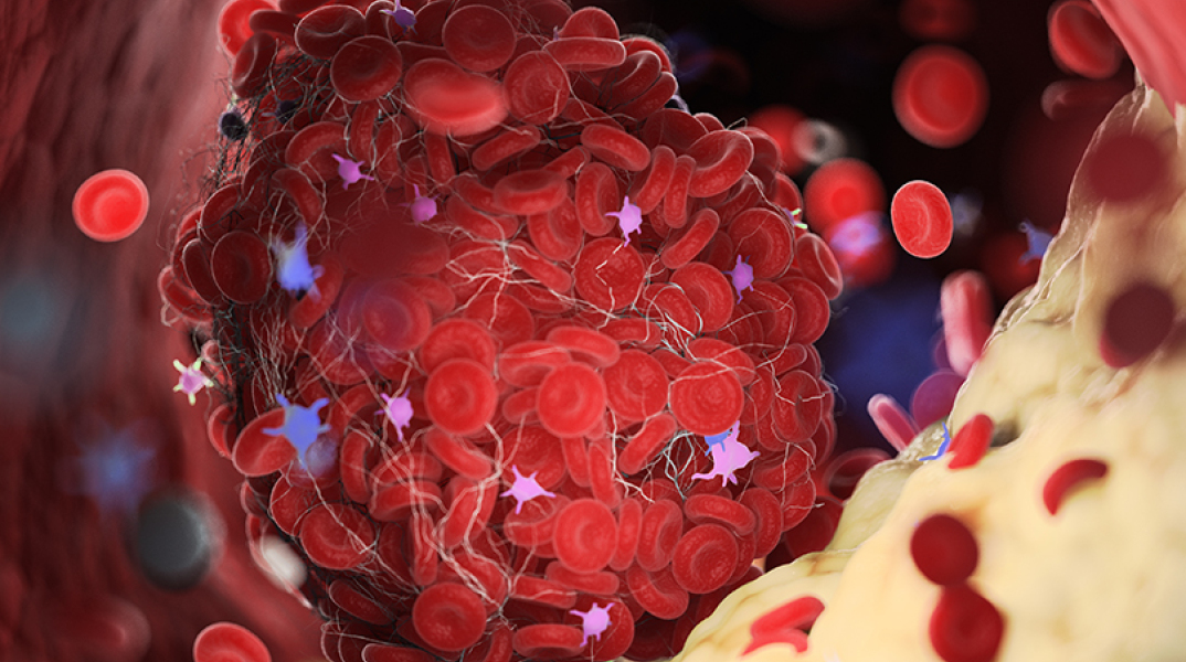 Πώς μπορεί να σώσει τη ζωή μας η διάγνωση των λιπιδίων