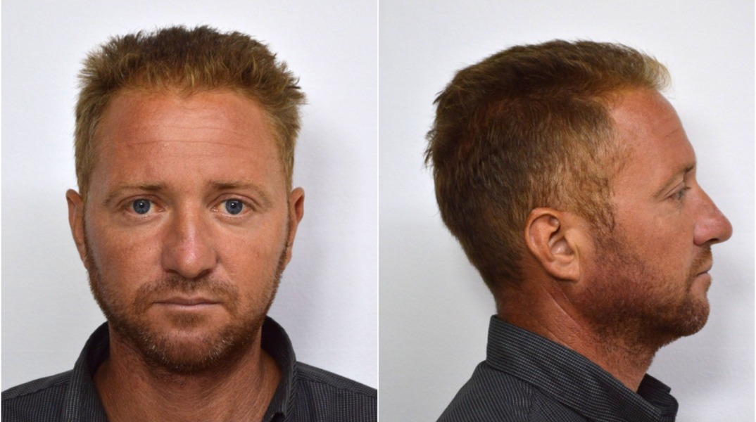 Πάτρα: Αυτός είναι ο 39χρονος που προφυλακίστηκε για ασέλγεια σε βάρος 6χρονης