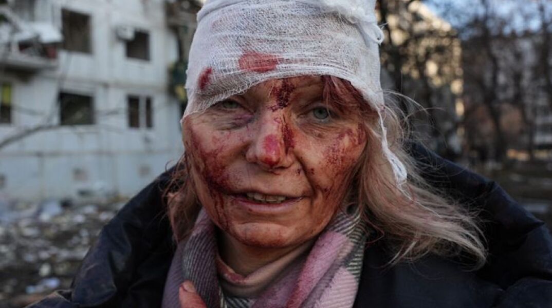 Η τραυματισμένη δασκάλα στην Ουκρανία έξω από το κατεστραμμένο σπίτι της στο Χάρκοβο