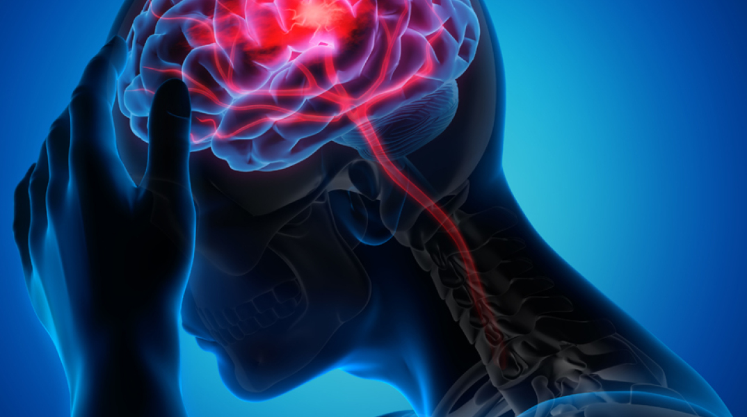 Βλάβες του εγκεφάλου: Αντιμετώπιση με ενδοαγγειακή χειρουργική 