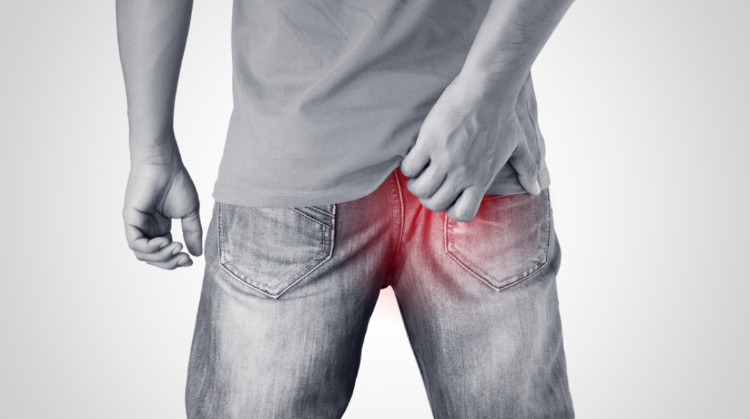 Βοηθάει η αποτρίχωση με λέιζερ στην κύστη κόκκυγα;