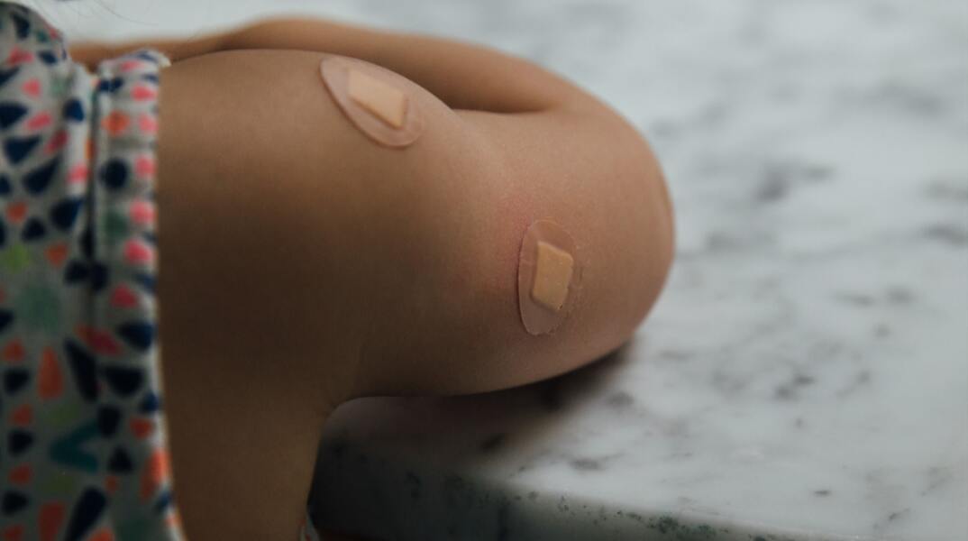 Τσιρότα στο μπράτσο ενός παιδιού στα σημεία όπου έγινε εμβόλιο
