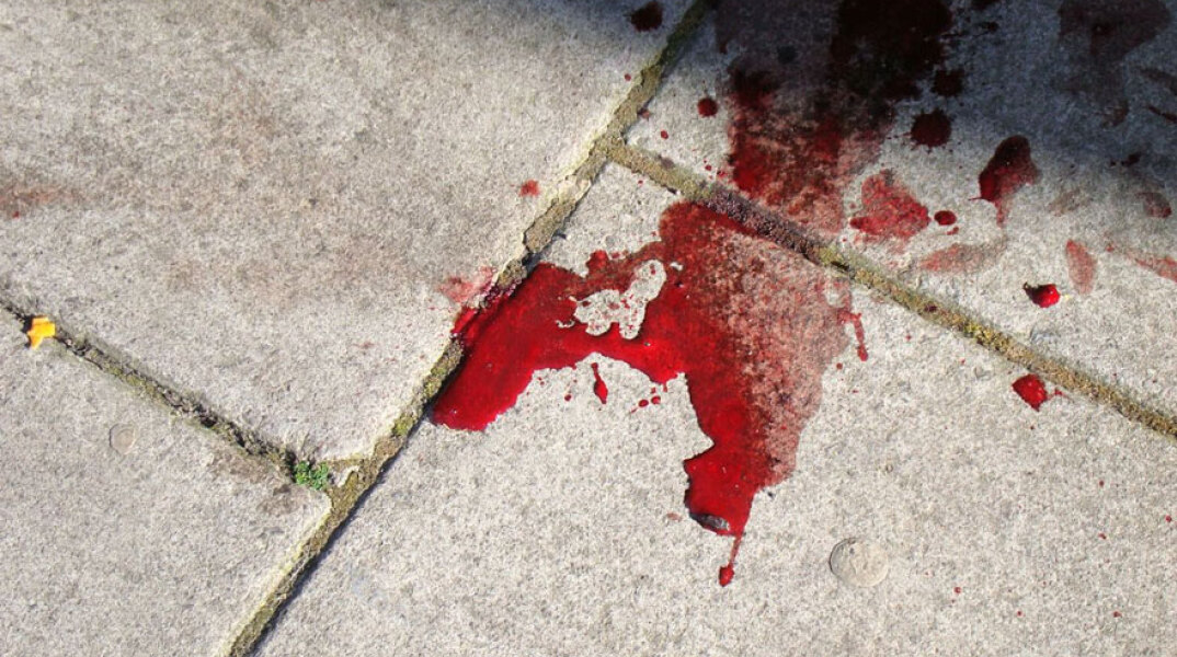 Στο κεφάλι με το αντικλεπτικό του τιμονιού χτύπησε 20χρονο ένας 55χρονος οδηγός στη Νέα Φιλαδέλφεια