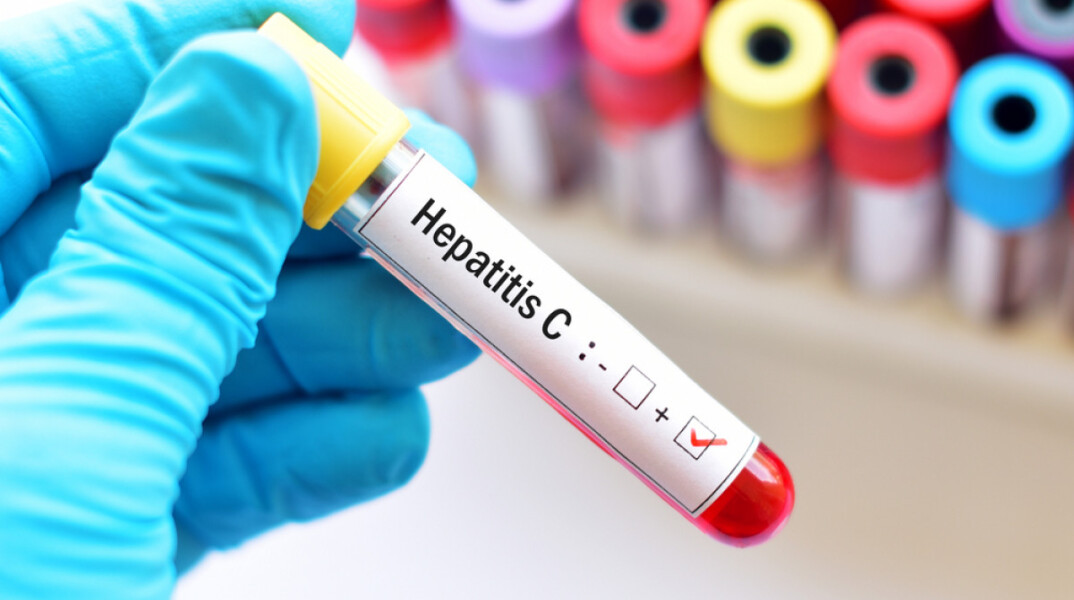 hepatitis-s.jpg
