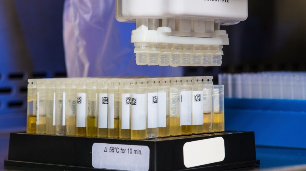 Νέο τεστ ανιχνεύει τα αντισώματα του κορωνοϊού στα ούρα και όχι στο αίμα