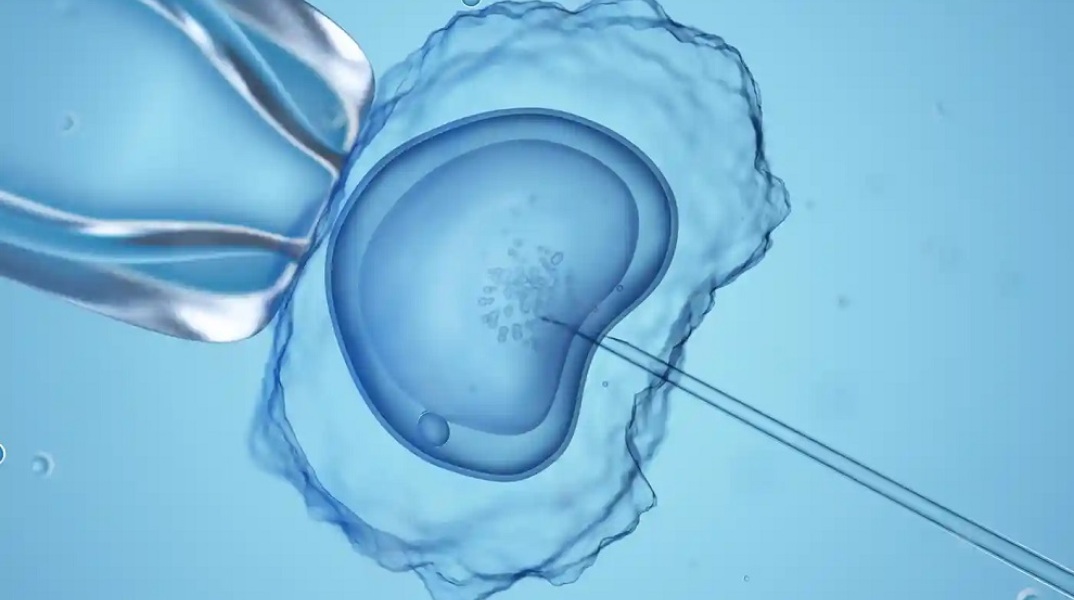 Δωρητής σπέρματος «έκρυβε» από λεσβίες το γενετικό σύνδρομό του που προκαλεί χαμηλό IQ και έκανε 15 παιδιά!