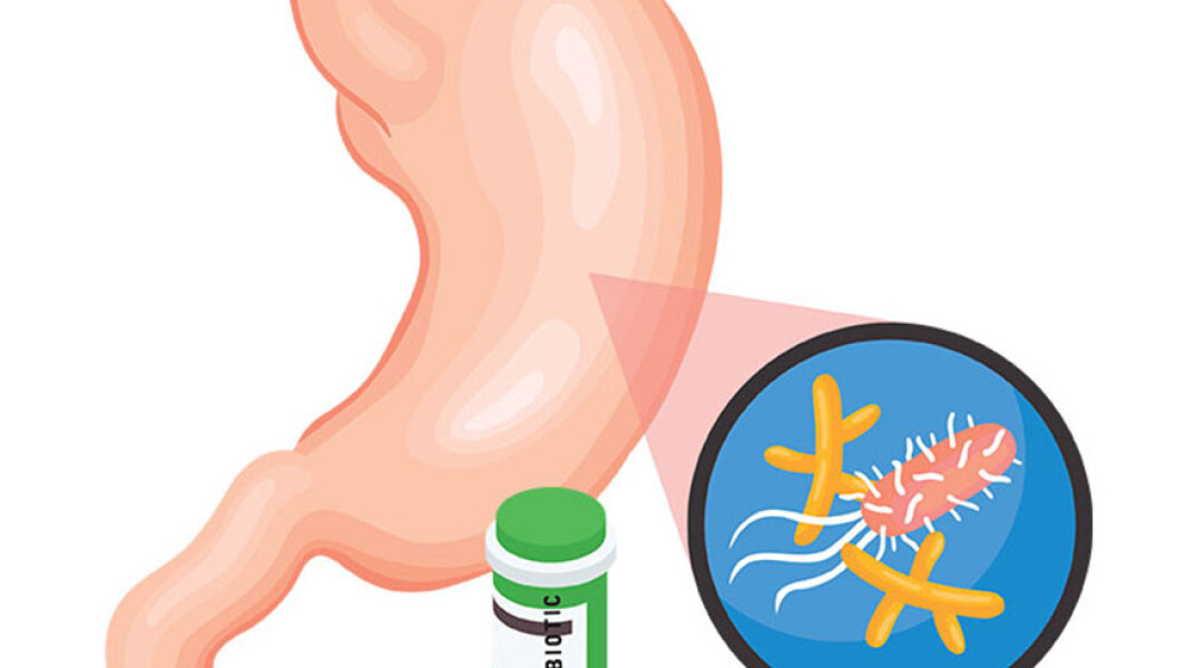 Εικονογράφηση που δείχνει το όργανο του σώματος στομάχι