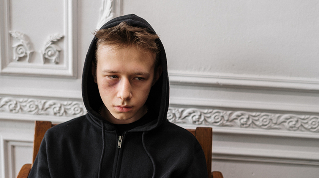 Έφηβος με μαύρο φούτερ και μελανιασμένα μάτια