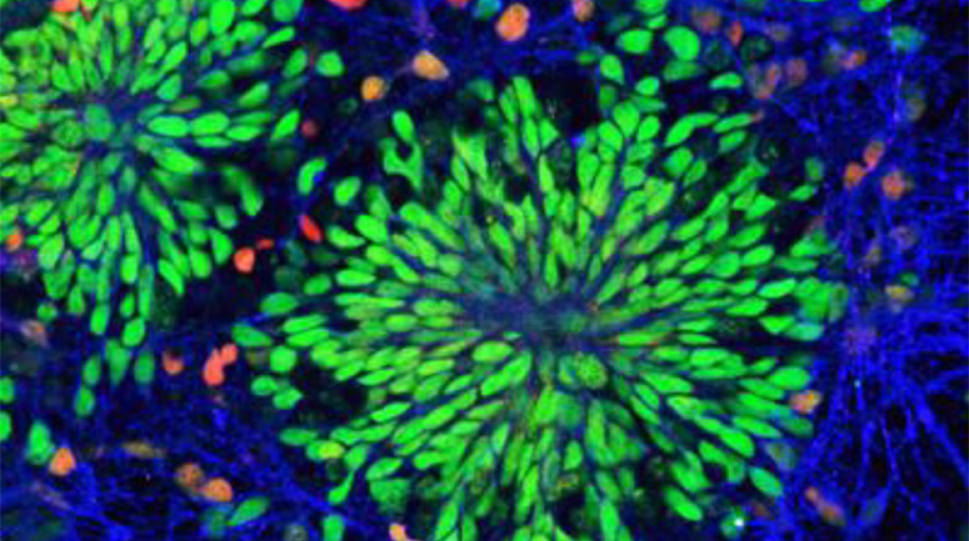 Νευρογένεση και Μνήμη