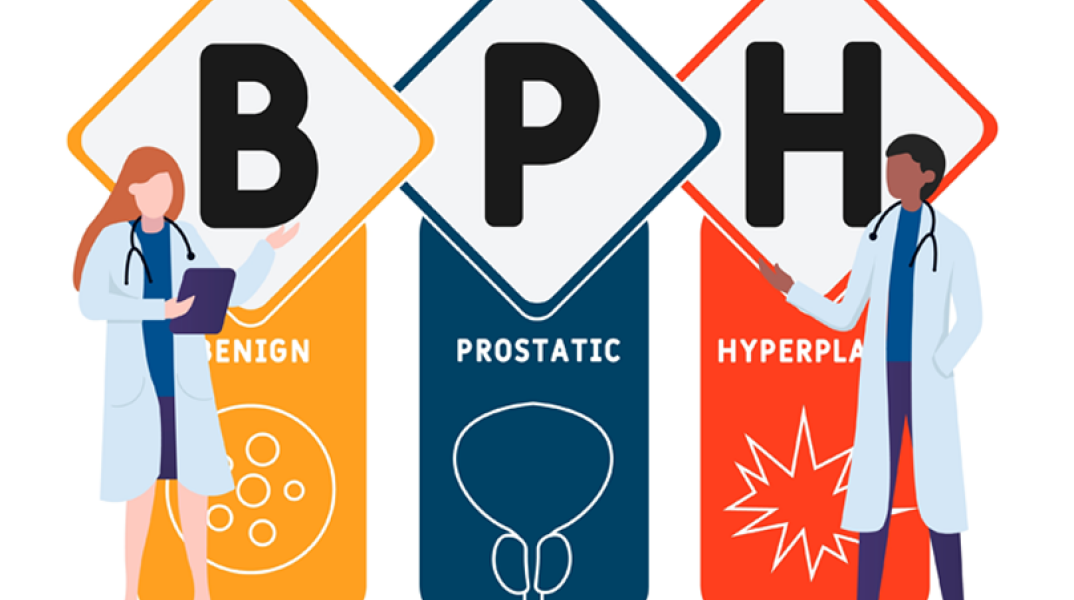 Καλοήθης υπερπλασία προστάτη: Νέα εποχή στην αντιμετώπισή της 