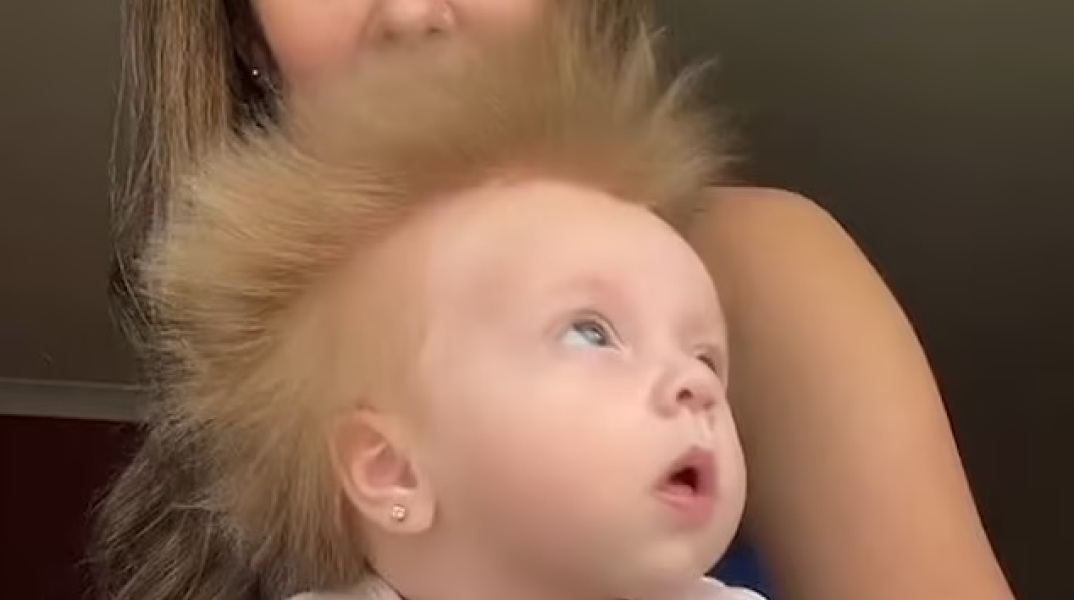 Μία μητέρα και το ηλικίας 10 εβδομάδων μωρό της έγιναν viral στο TikTok, καθώς τα μαλλιά του παιδιού πετάνε προς κάθε κατεύθυνση.