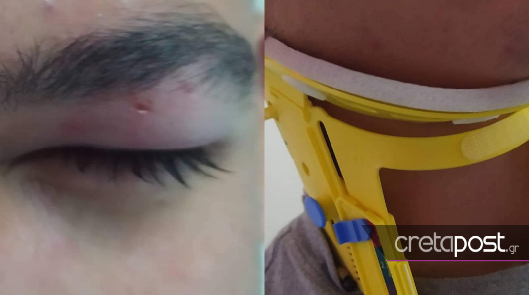 Στο νοσοκομείο μαθητής Λυκείου μετά τον ξυλοδαρμό του από οδηγό αυτοκινήτου