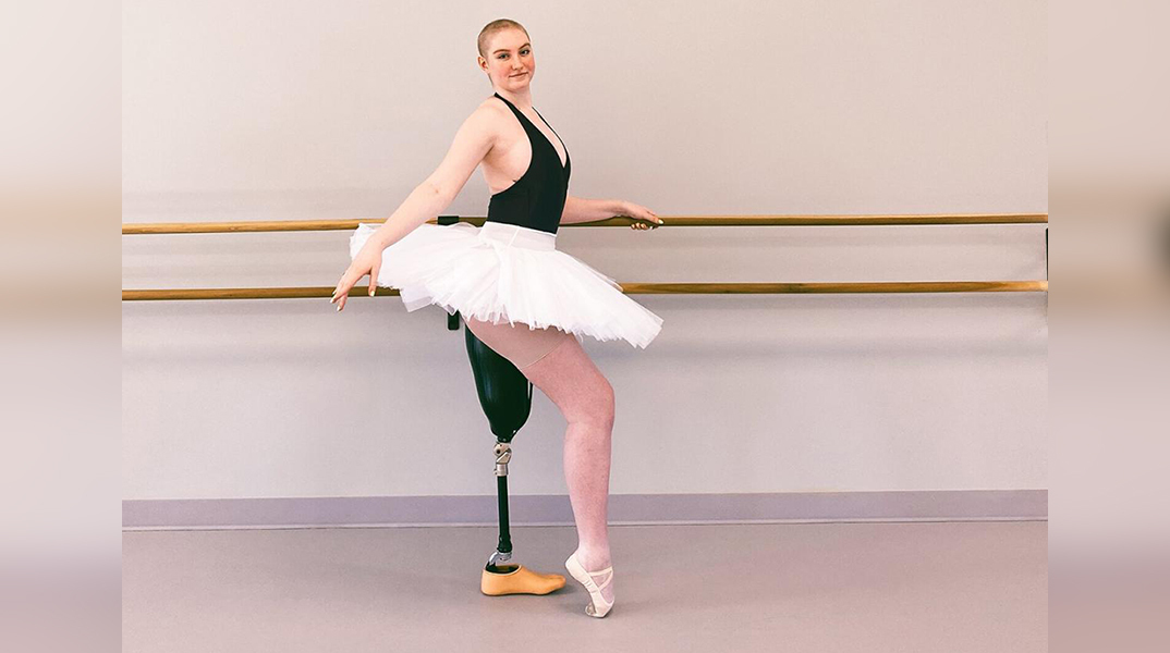 Kara Skrubis, η 21χρονη μπαλαρίνα που χορεύει με πρόσθετο πόδι μετά τον ακρωτηριασμό της