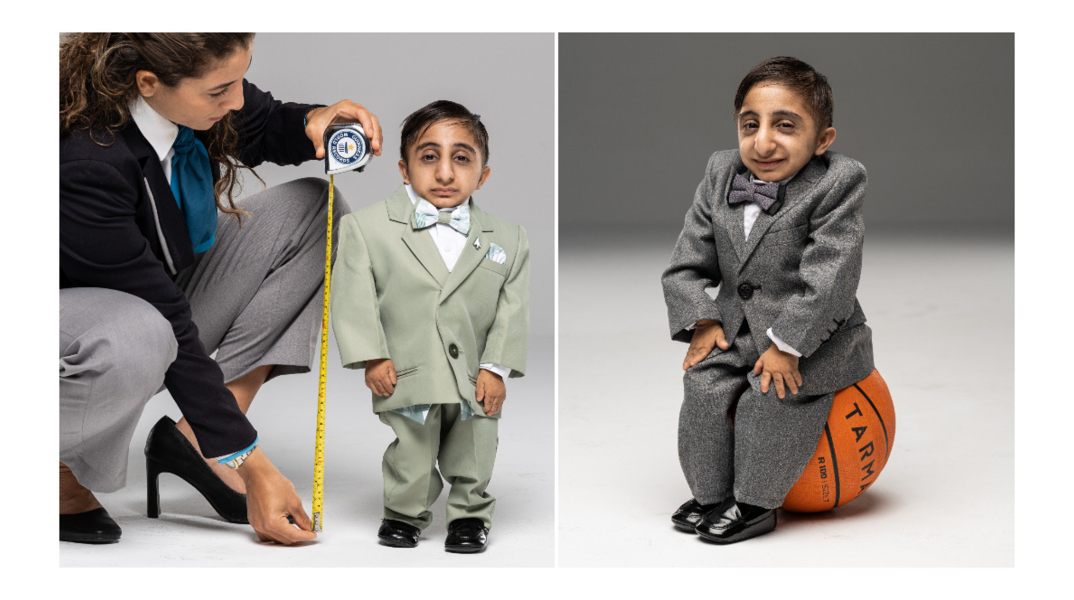 Ο πιο κοντός εν ζωή άνθρωπος του κόσμου είναι ο Αφσίν Ισμαήλ Γκαντερζαντέχ, με 65,24 εκατοστά - Ο 20χρονος Ιρανός πέρασε στο βιβλίο των ρεκόρ Γκίνες. 