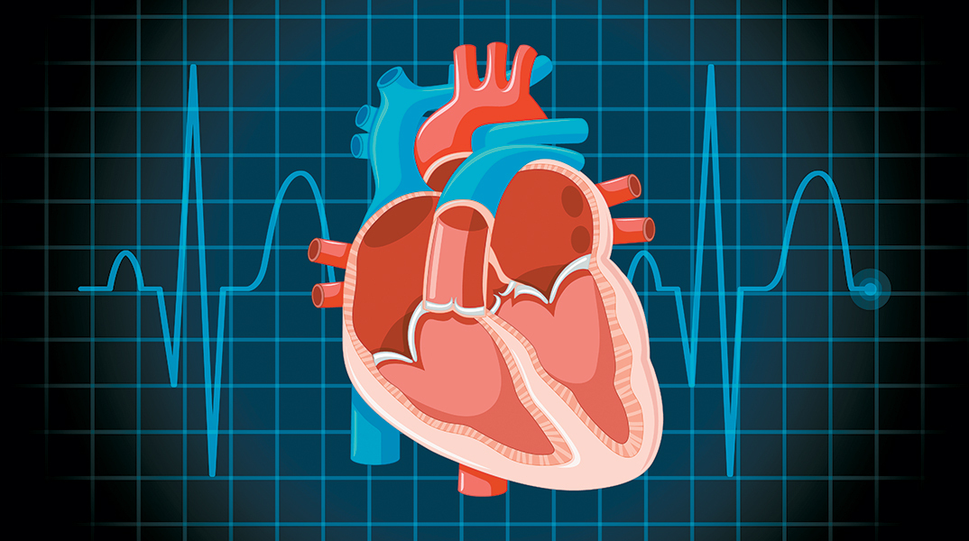 Διαδερμική επεμβατική θεραπεία: Το μέλλον στην αντιμετώπιση της καρδιακής ανεπάρκειας