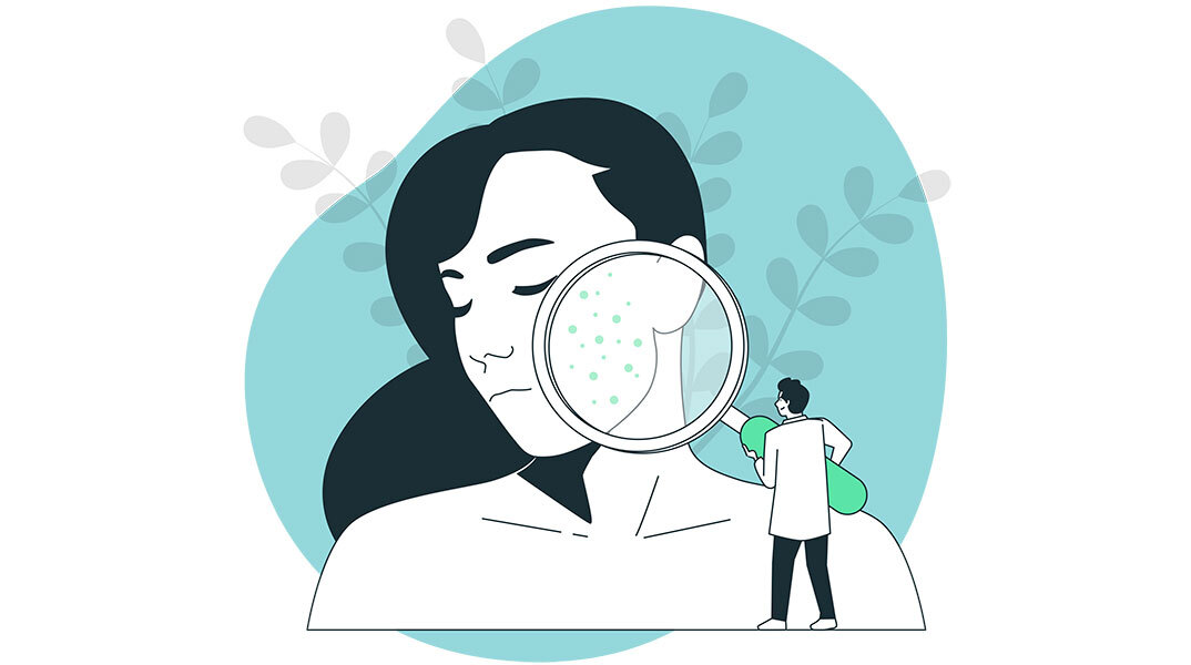 Φάκελος Ψωρίαση: Σύγχρονοι θεραπευτικοί στόχοι