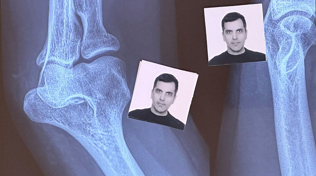 Φωτογραφίες ταυτότητας πάνω σε ακτινογραφία