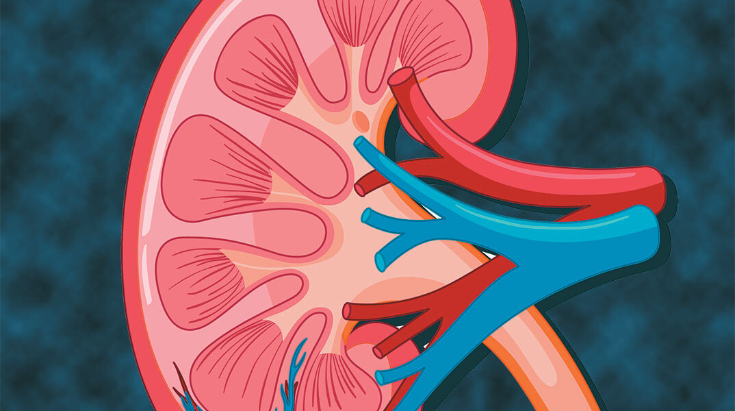 Νέα εποχή στον καρκίνο του νεφρού